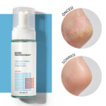 Callus Foam, Nasır Sökücü Köpük, Pedikür için Keratolitik, 150 ml