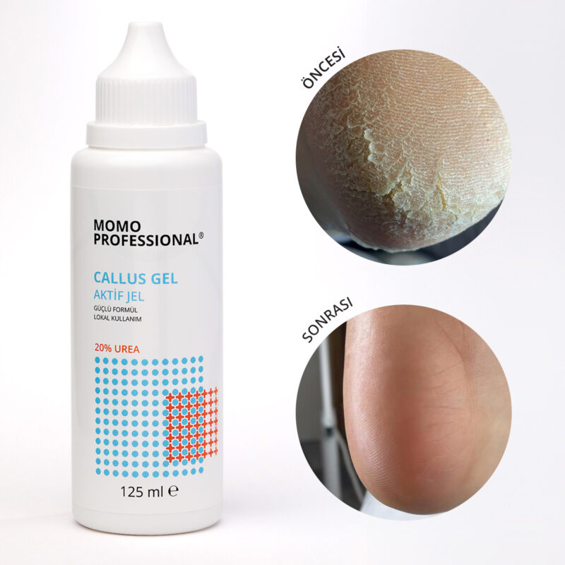 CallusGel 02